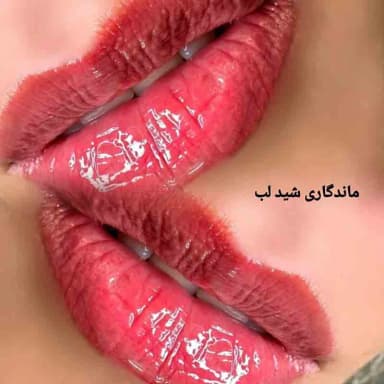 تصویر آگهی شماره 10