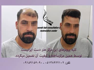 تصویر آگهی شماره 6