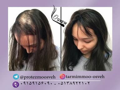 تصویر آگهی شماره 9