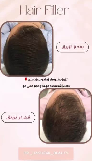 تصویر آگهی شماره 5