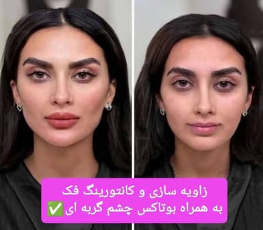 تصویر آگهی شماره 11