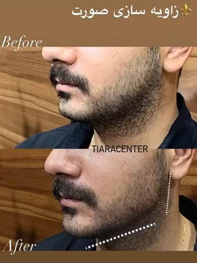 تصویر آگهی شماره 17