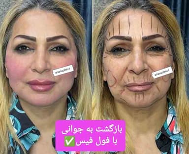 تصویر آگهی شماره 9