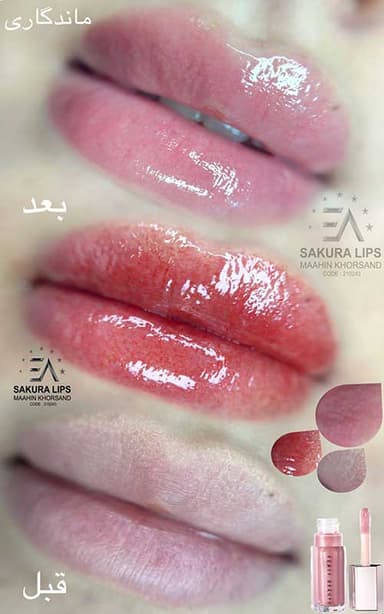 تصویر آگهی شماره 6