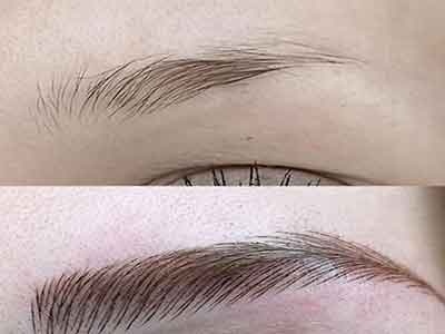 بهترین فیبروز ابرو در مشهد