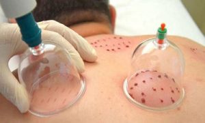 حجامت در تهران