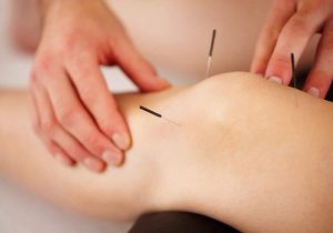 طب سوزنی در کرج