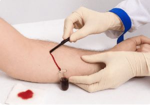 فصد خون در تهران