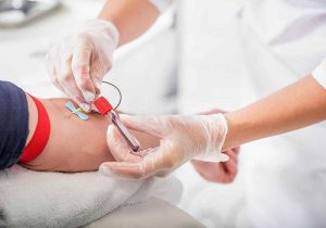 فصد خون در کرج