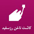 کاشت-ناخن-رز-سفید-در-مشهد.jpg