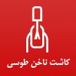 کاشت-ناخن-زینت-طوسی-در-مشهد.jpg